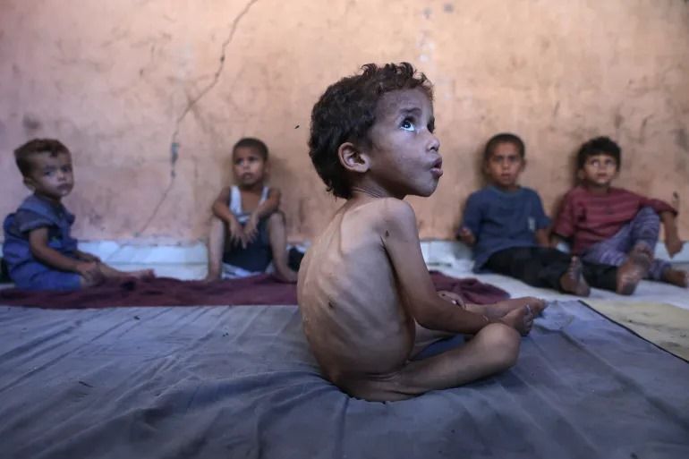 Gaza, la faim comme arme : une faillite morale et durable